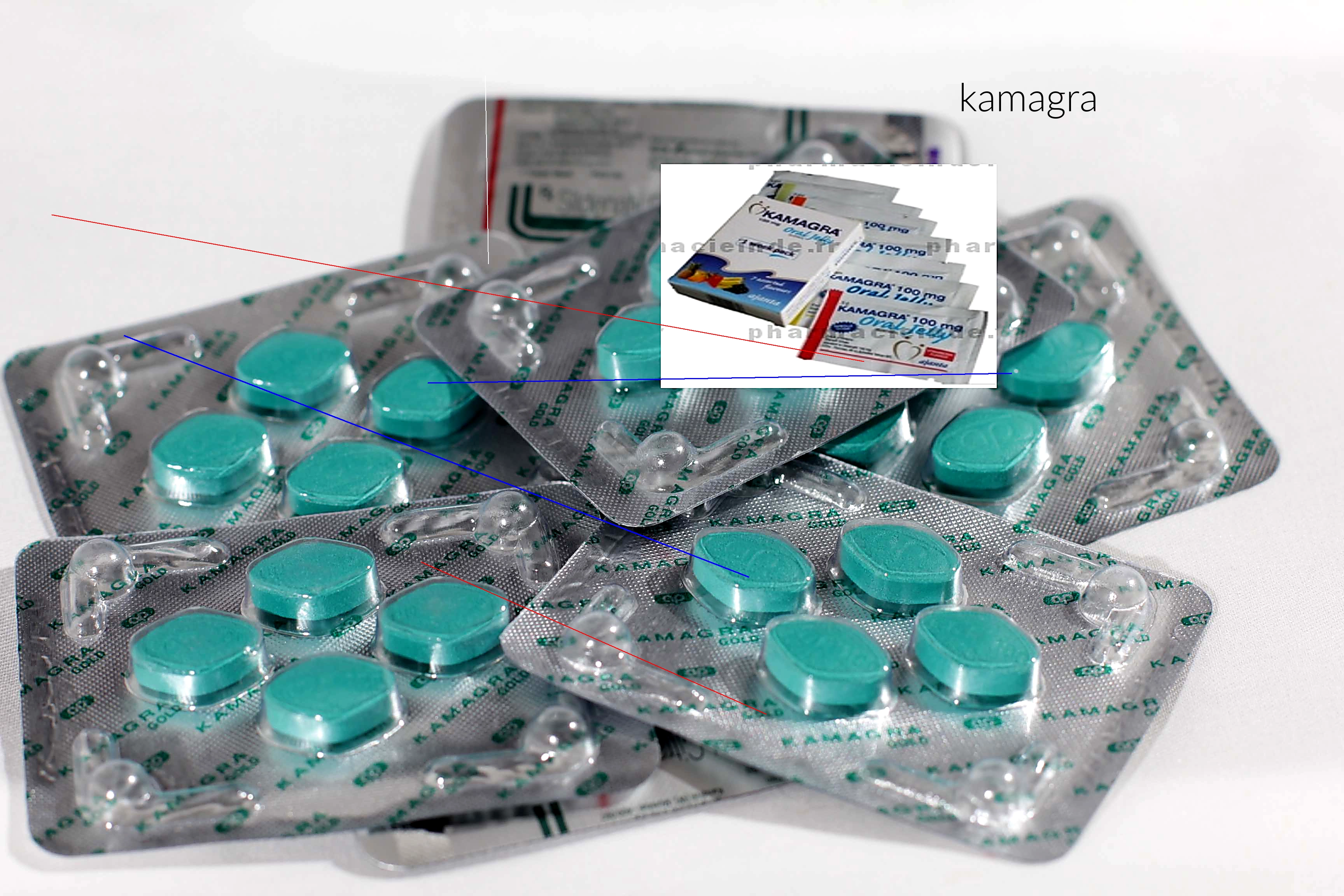 Kamagra achat en france